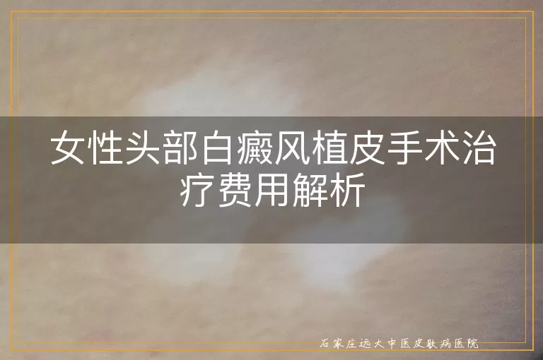 女性头部白癜风植皮手术治疗费用解析