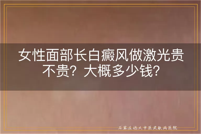 女性面部长白癜风做激光贵不贵？大概多少钱？