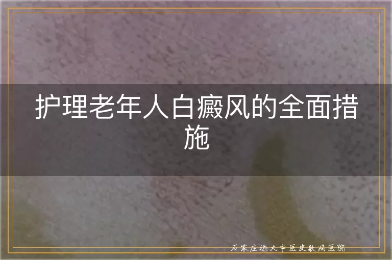 护理老年人白癜风的全面措施