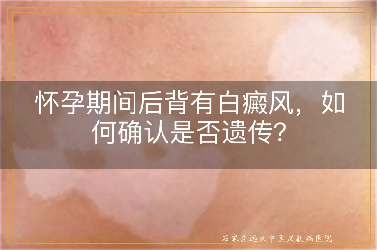 怀孕期间后背有白癜风，如何确认是否遗传？