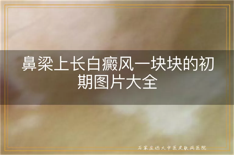 鼻梁上长白癜风一块块的初期图片大全
