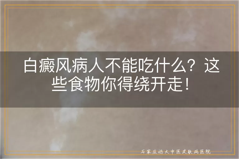 白癜风病人不能吃什么？这些食物你得绕开走！
