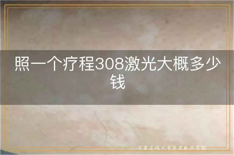 照一个疗程308激光大概多少钱