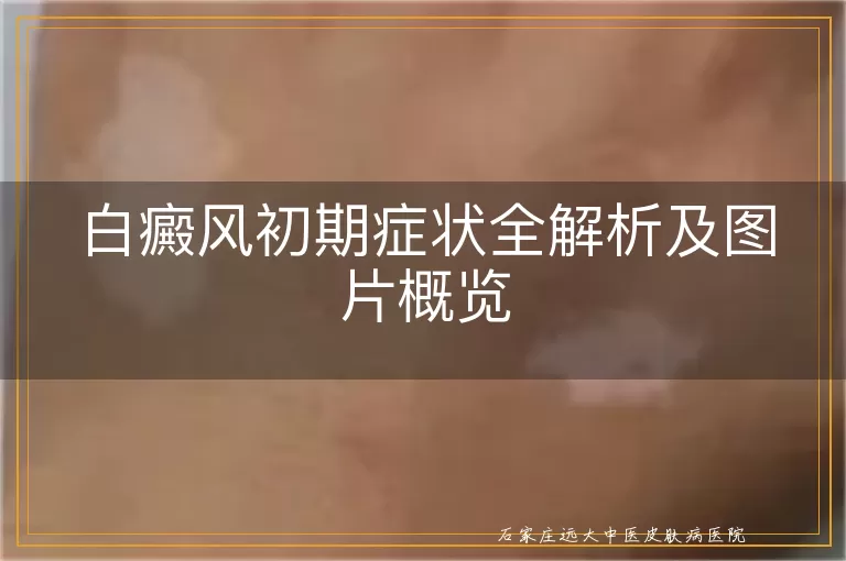 白癜风初期症状全解析及图片概览