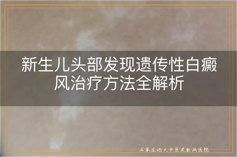 新生儿头部发现遗传性白癜风治疗方法全解析