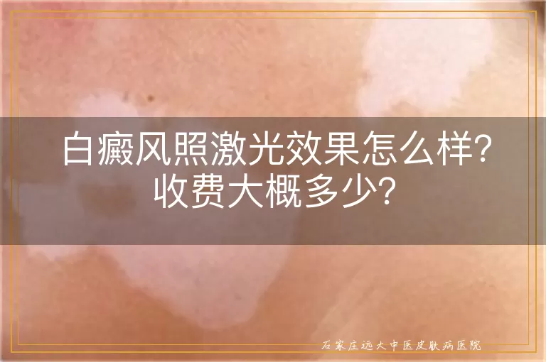 白癜风照激光效果怎么样？收费大概多少？