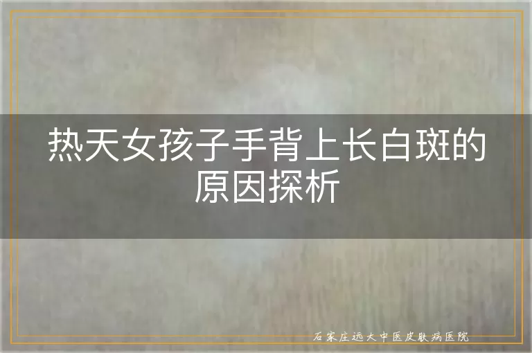 热天女孩子手背上长白斑的原因探析
