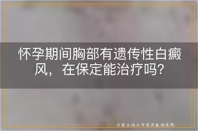 怀孕期间胸部有遗传性白癜风，在保定能治疗吗？