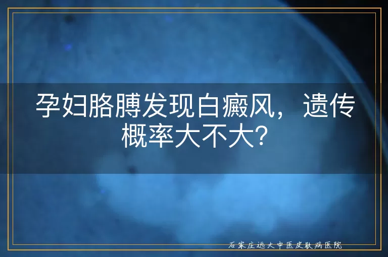 孕妇胳膊发现白癜风，遗传概率大不大？