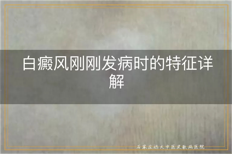 白癜风刚刚发病时的特征详解
