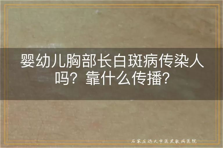 婴幼儿胸部长白斑病传染人吗？靠什么传播？