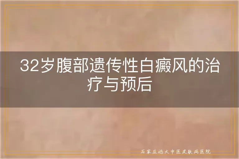 32岁腹部遗传性白癜风的治疗与预后