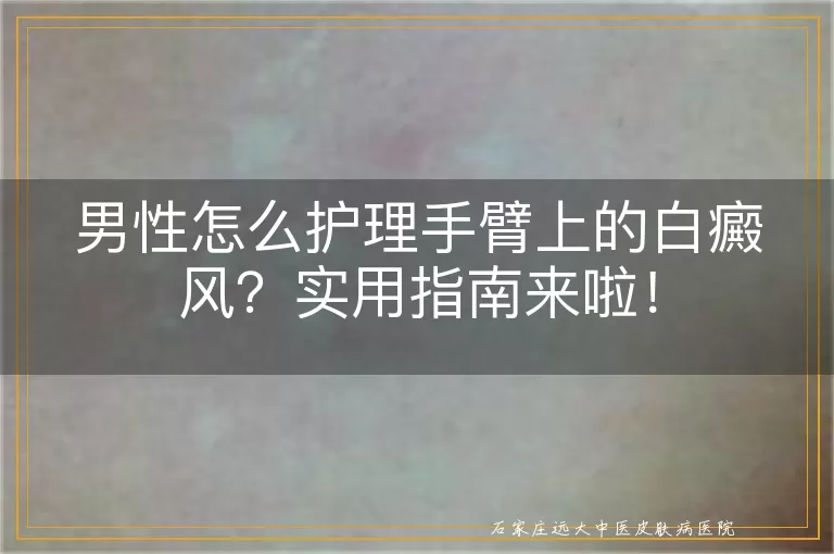男性怎么护理手臂上的白癜风？实用指南来啦！