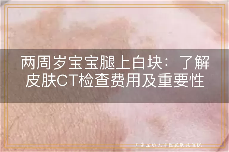 两周岁宝宝腿上白块：了解皮肤CT检查费用及重要性