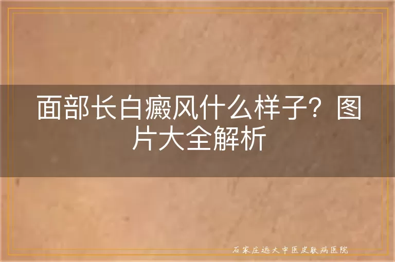 面部长白癜风什么样子？图片大全解析