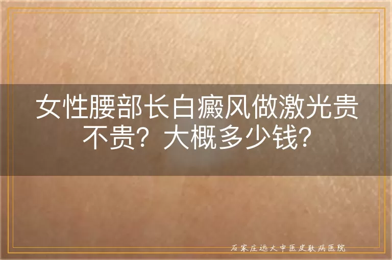 女性腰部长白癜风做激光贵不贵？大概多少钱？