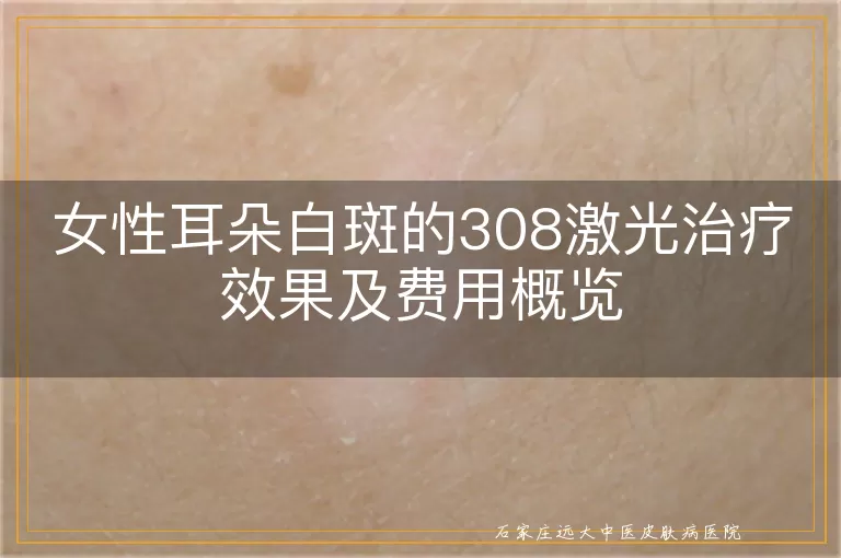女性耳朵白斑的308激光治疗效果及费用概览