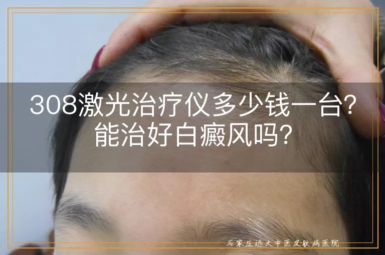 308激光治疗仪多少钱一台？能治好白癜风吗？