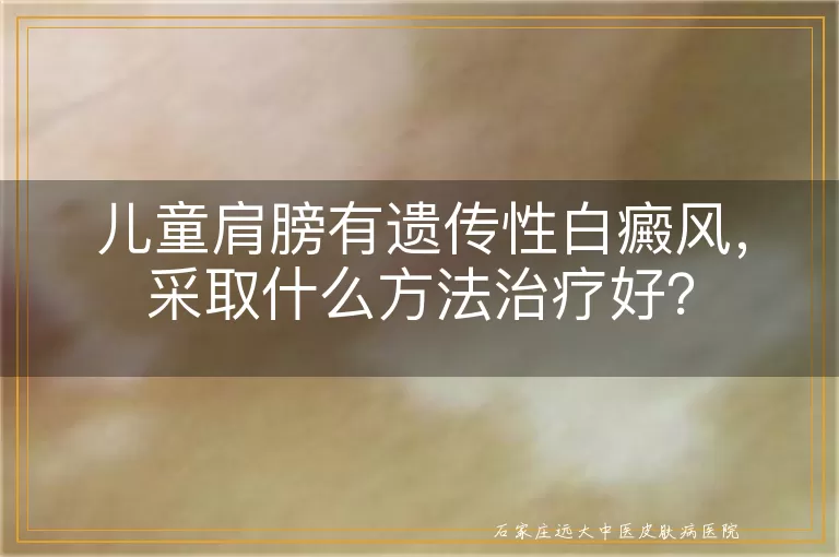 儿童肩膀有遗传性白癜风，采取什么方法治疗好？
