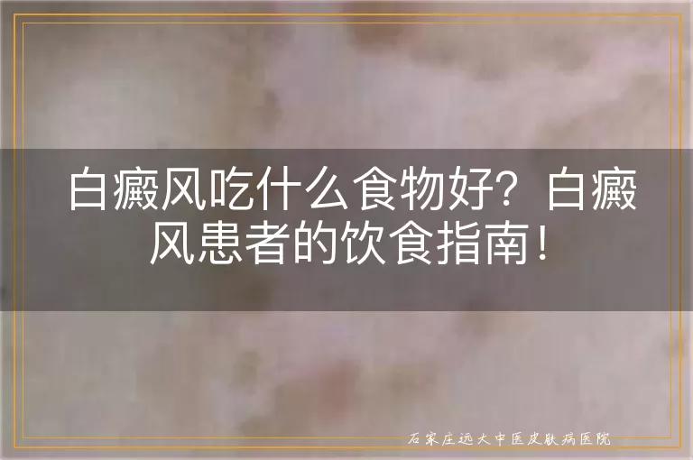 白癜风吃什么食物好？白癜风患者的饮食指南！
