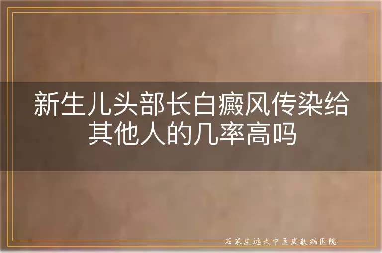 新生儿头部长白癜风传染给其他人的几率高吗