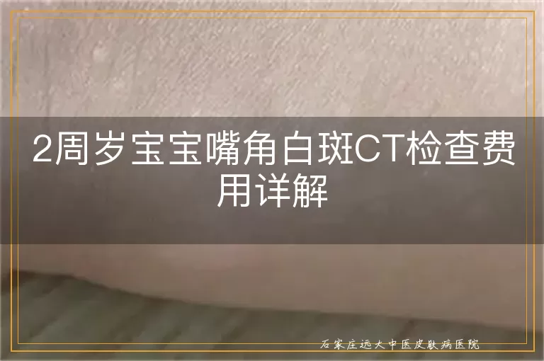 2周岁宝宝嘴角白斑CT检查费用详解