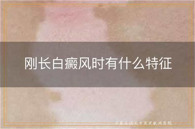 刚长白癜风时有什么特征