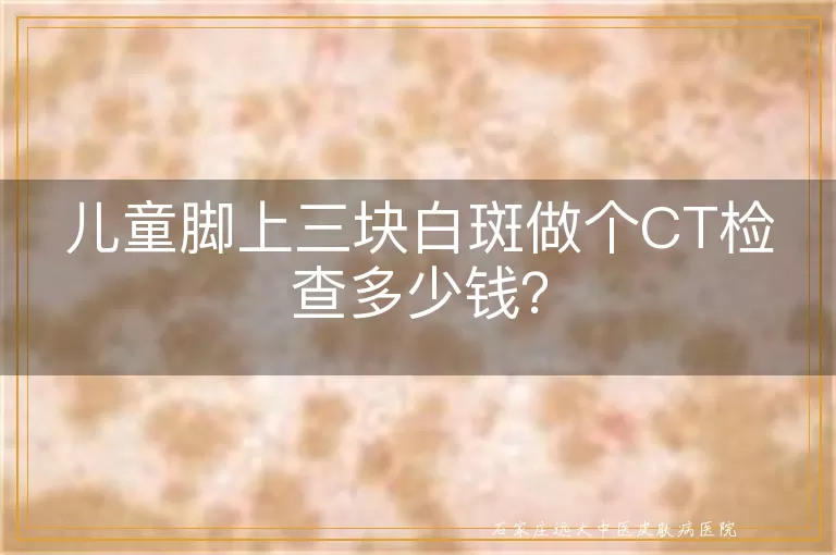儿童脚上三块白斑做个CT检查多少钱？