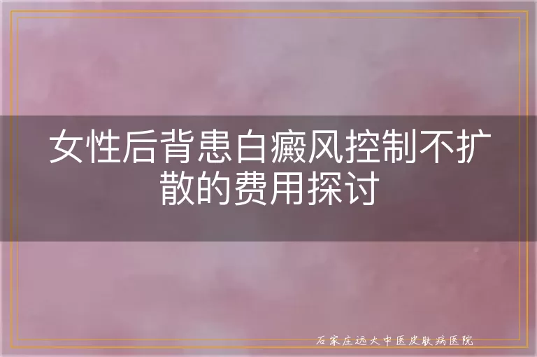 女性后背患白癜风控制不扩散的费用探讨