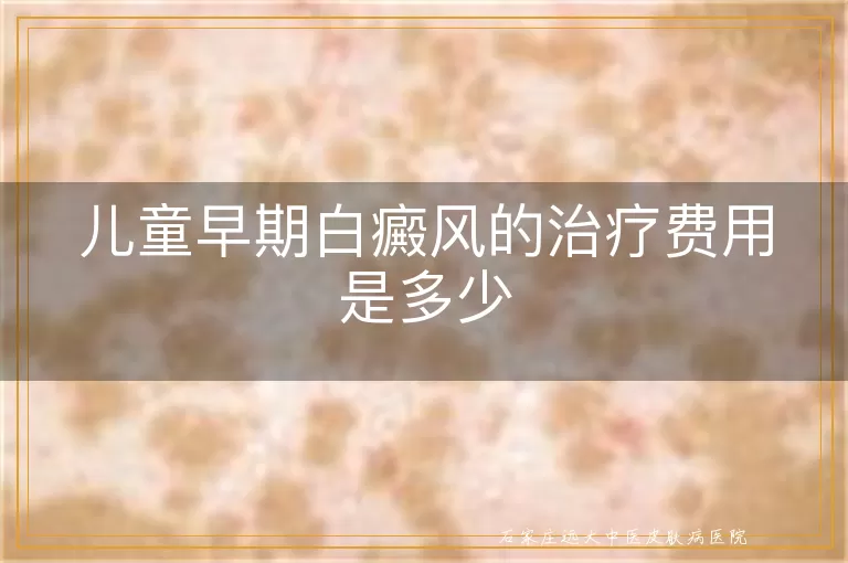 儿童早期白癜风的治疗费用是多少