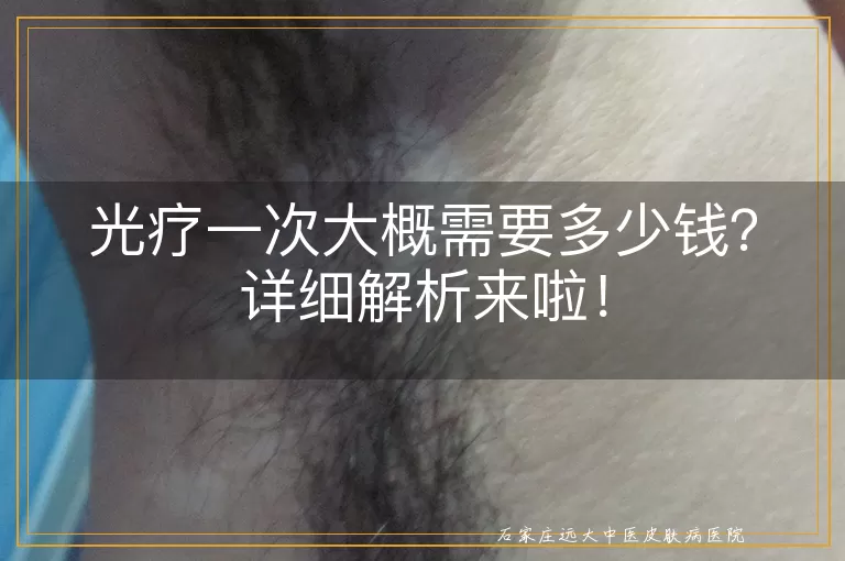 光疗一次大概需要多少钱？详细解析来啦！