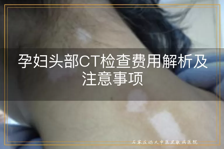 孕妇头部CT检查费用解析及注意事项