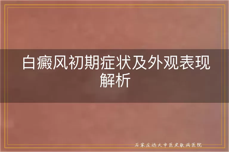 白癜风初期症状及外观表现解析