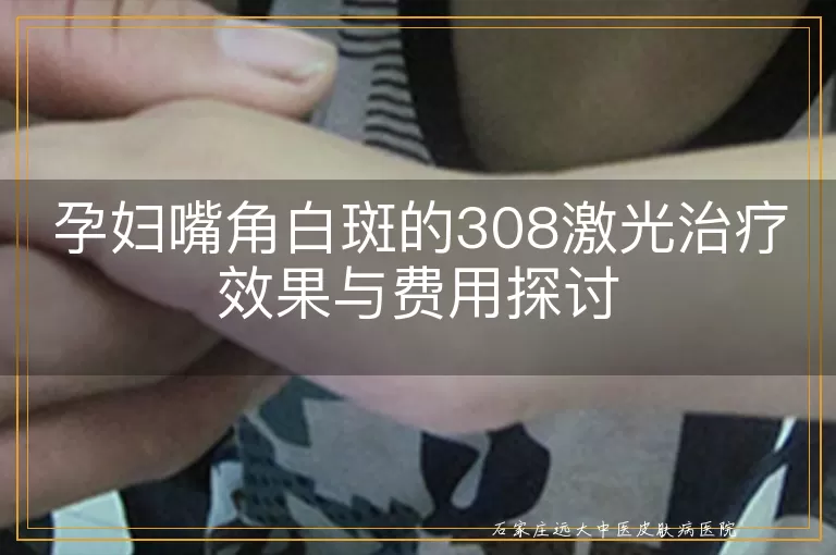 孕妇嘴角白斑的308激光治疗效果与费用探讨