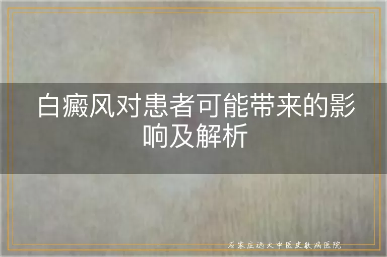 白癜风对患者可能带来的影响及解析