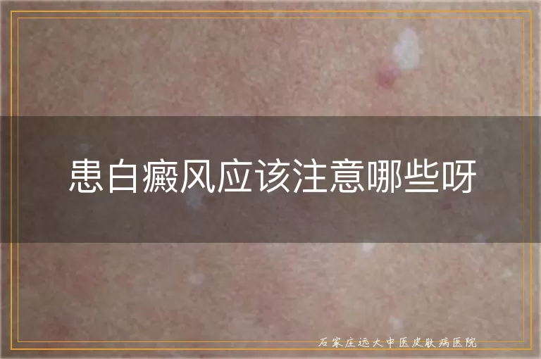 患白癜风应该注意哪些呀