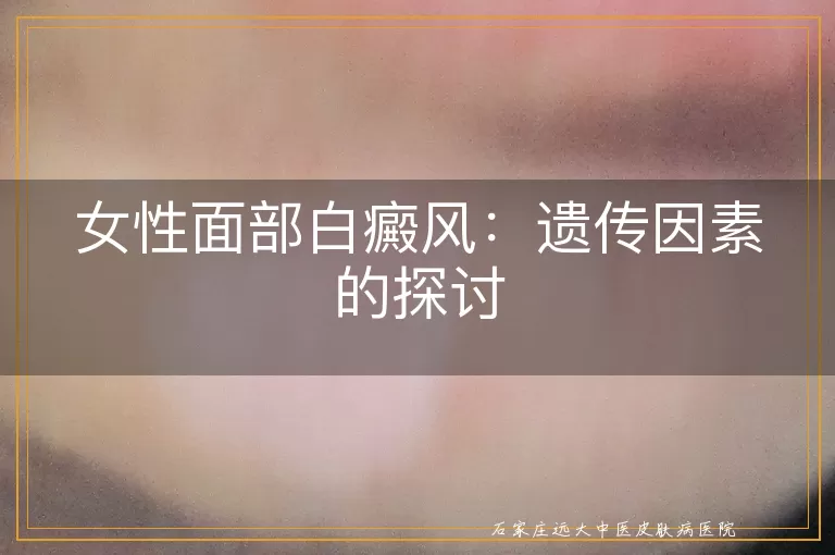 女性面部白癜风：遗传因素的探讨