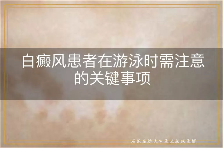 白癜风患者在游泳时需注意的关键事项