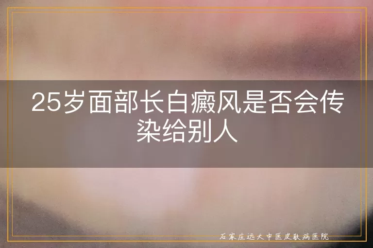 25岁面部长白癜风是否会传染给别人