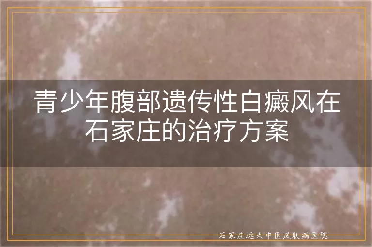 青少年腹部遗传性白癜风在石家庄的治疗方案