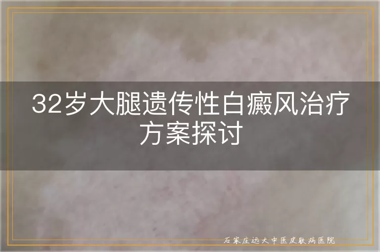 32岁大腿遗传性白癜风治疗方案探讨