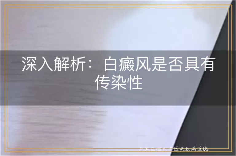深入解析：白癜风是否具有传染性