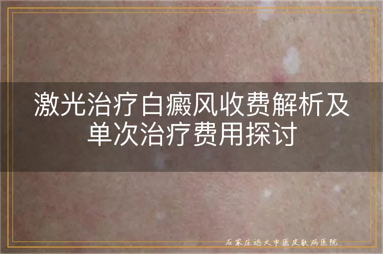 激光治疗白癜风收费解析及单次治疗费用探讨