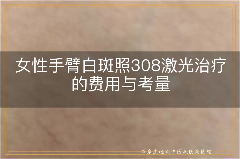 女性手臂白斑照308激光治疗的费用与考量