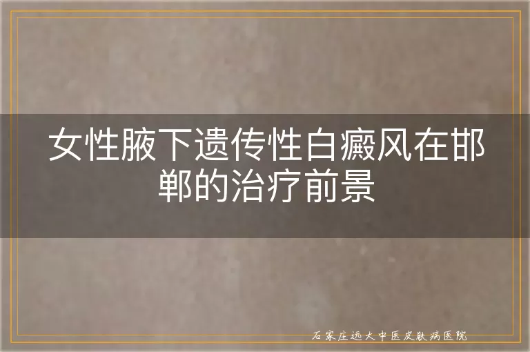 女性腋下遗传性白癜风在邯郸的治疗前景