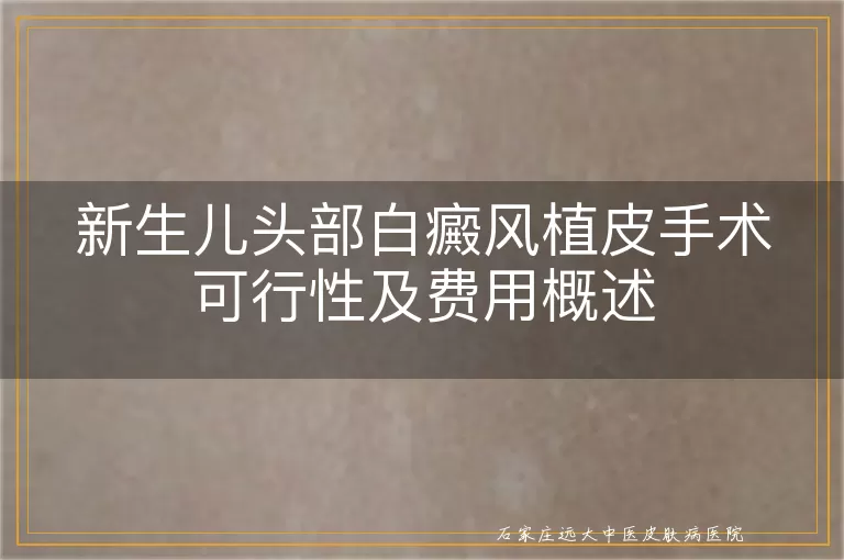 新生儿头部白癜风植皮手术可行性及费用概述
