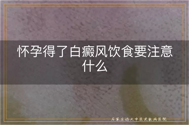 怀孕得了白癜风饮食要注意什么