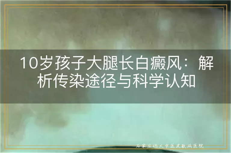 10岁孩子大腿长白癜风：解析传染途径与科学认知