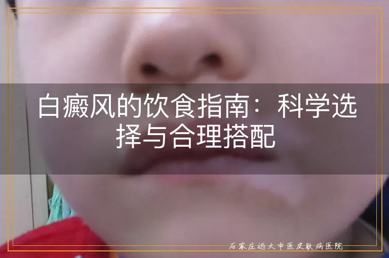 白癜风的饮食指南：科学选择与合理搭配