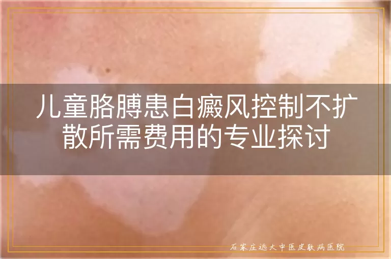 儿童胳膊患白癜风控制不扩散所需费用的专业探讨